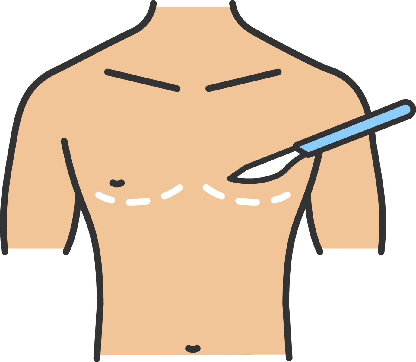 Gynecomastia treatment at Nords Weight Loss Clinic